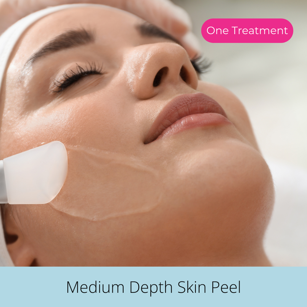 Medium Depth Skin Peel